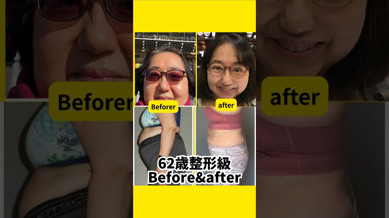【62歳】衝撃のビフォーアフター❗同一人物？！整形疑惑？ img
