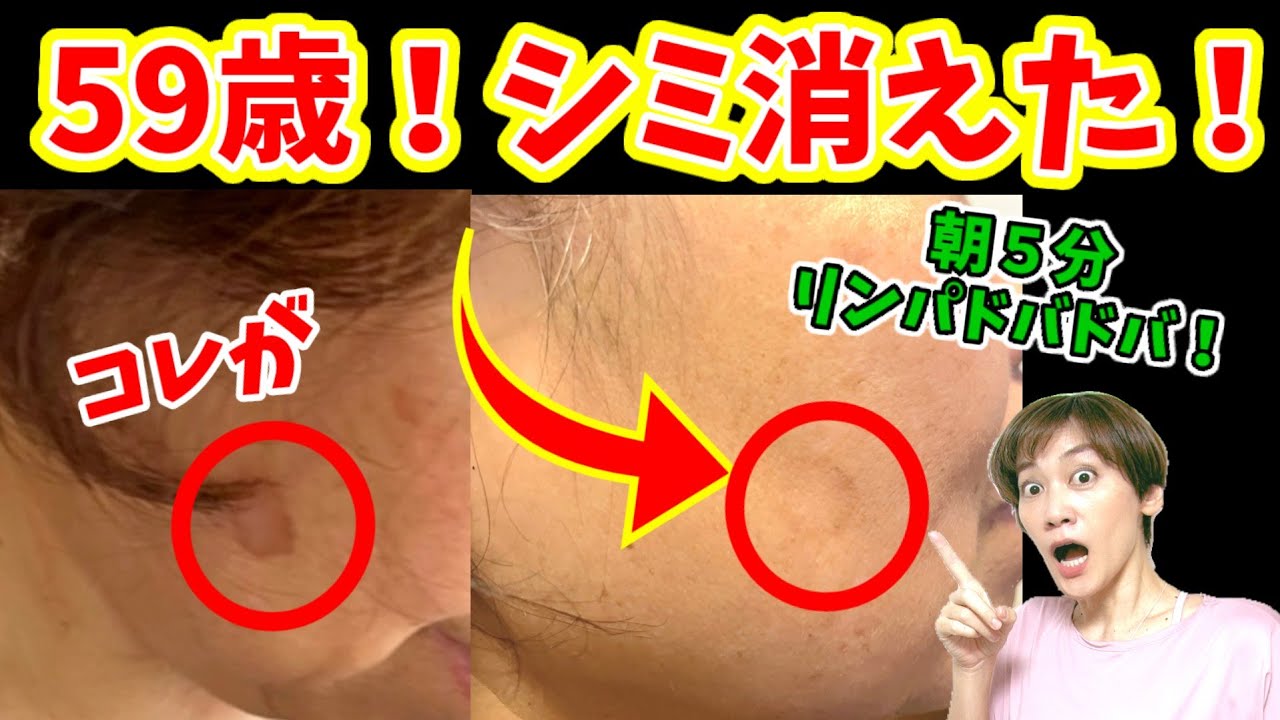 整形級！顔のシミ消えた！朝５分でリンパドバドバ❕若返る♪ img