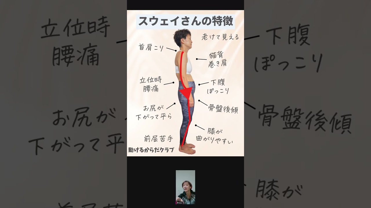 スウェイバックとは？反り腰との違いと見た目の変化 img